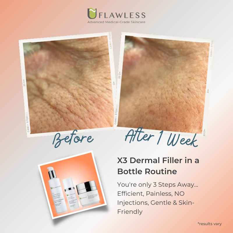 X3 Dermal Filler in a Bottle Routine