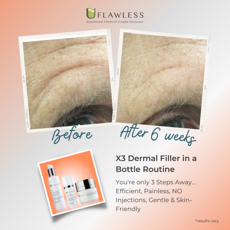 X3 Dermal Filler in a Bottle Routine