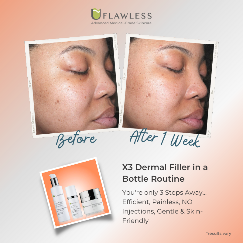 X3 Dermal Filler in a Bottle Routine