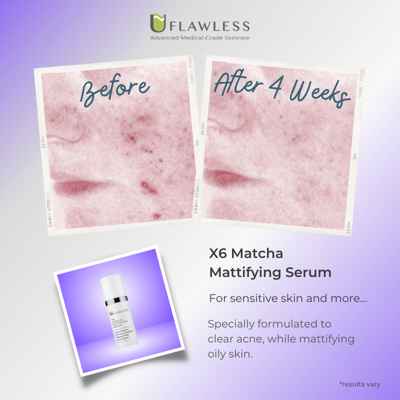X6 Matcha Mattifying Serum | Skin Care Serum