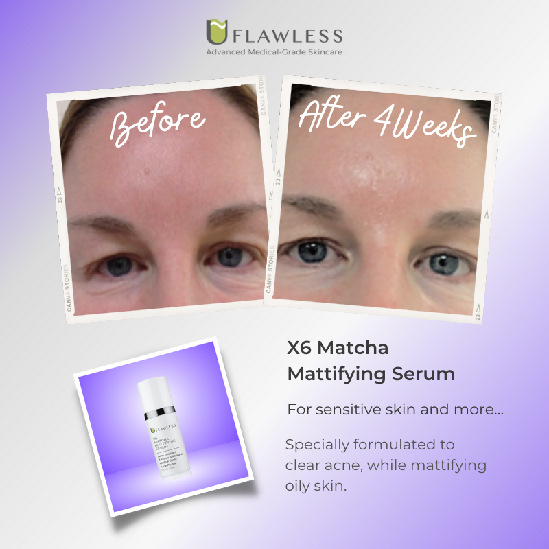 X6 Matcha Mattifying Serum | Skin Care Serum