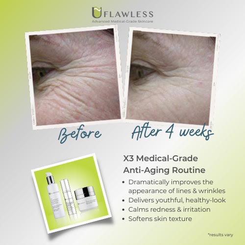 X3 Anti-Aging Routine | Samples |