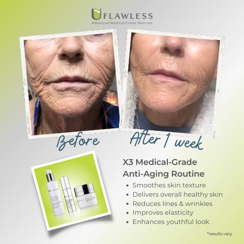 X3 Anti-Aging Routine | Samples |