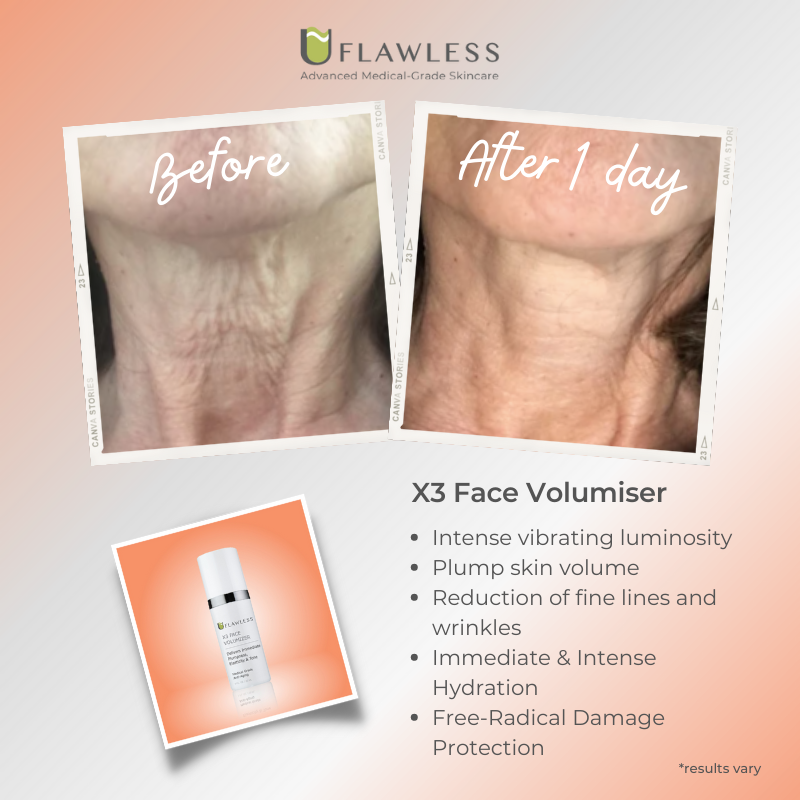 X3 Dermal Filler in a Bottle Routine