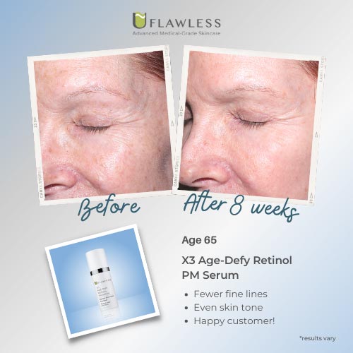 X3 Age-Defy Retinol PM Serum | Skincare Renewal