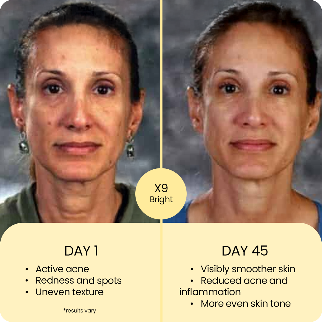 X9 Advanced Brightening Routine