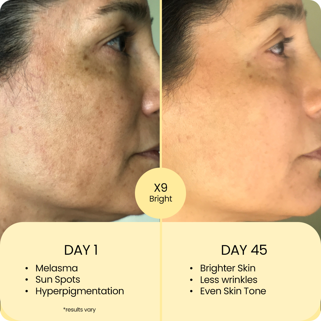 X9 Advanced Brightening Routine