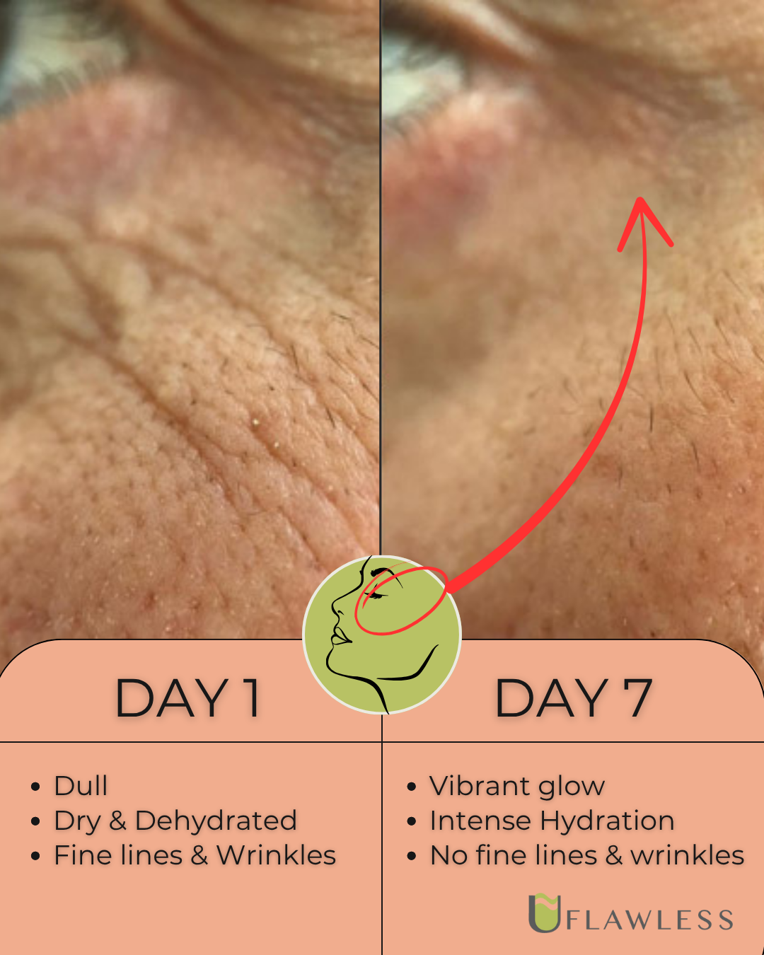 X3 Dermal Filler in a Bottle Routine